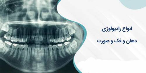 مجموعه فیلم های آموزشی جامع تکنیک های عملی رادیولوژی دهان و دندان 